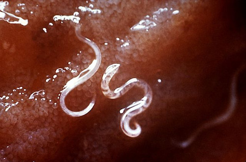 intestinal worms hookworm prevention