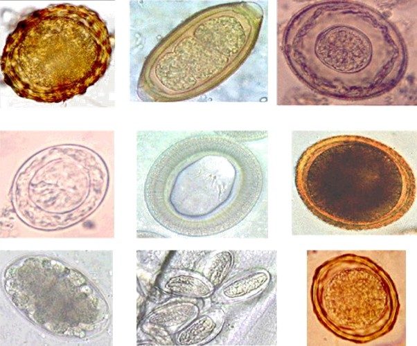 intestinal worm eggs types